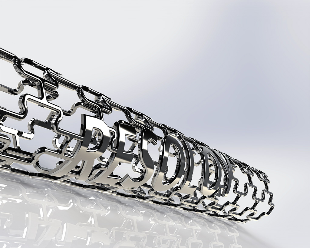 Stents: Magnesium (Mg) alloy